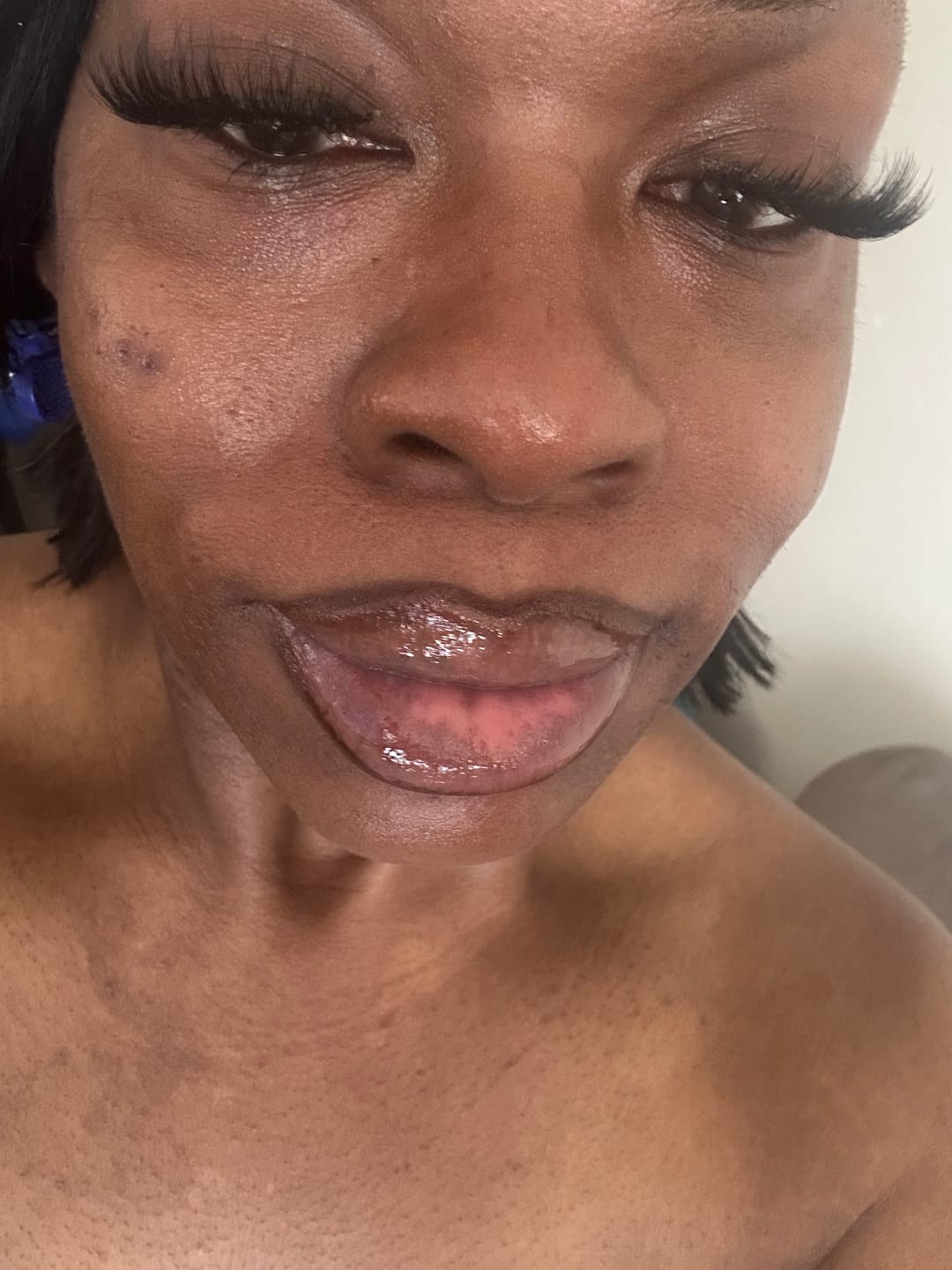 Customer photo review of Kojic Acid X Vitamin C Brightening Soap