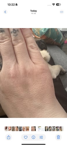 Customer photo review of Calm Balm