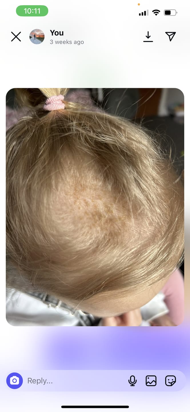 Customer photo review of Baby Scalp Oil