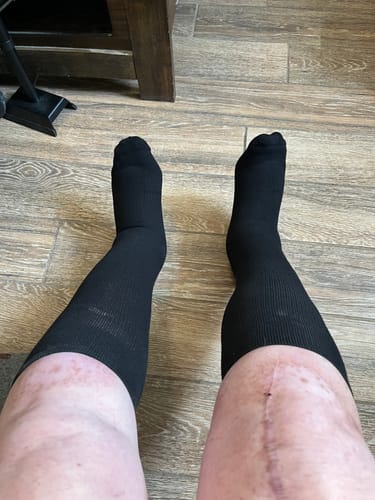 Customer photo review of Performance Eucalyptus Compression Socks