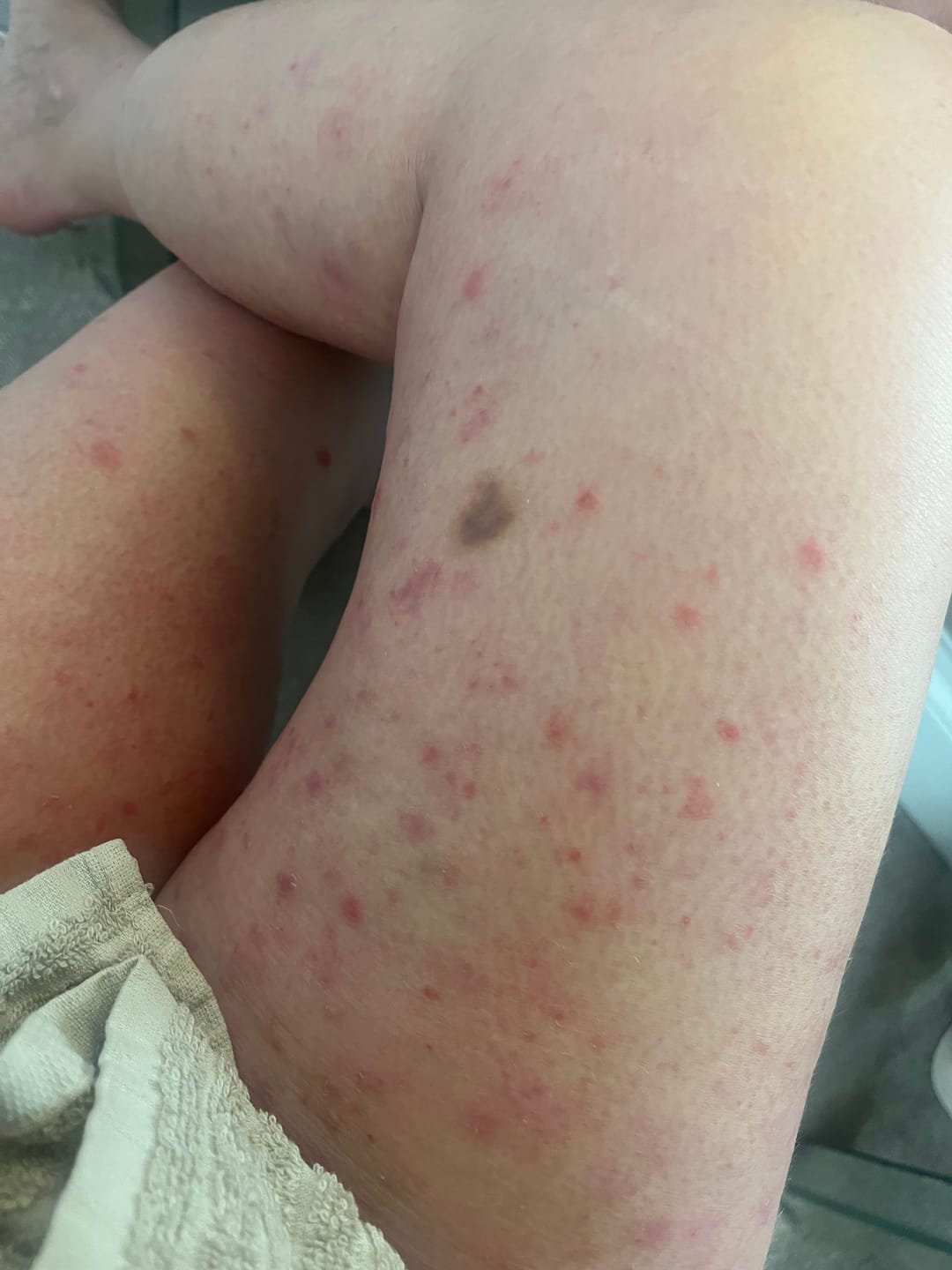 Customer photo review of Scar Minimising Oil