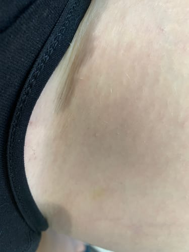 Customer photo review of Probiotic Intimate Wash