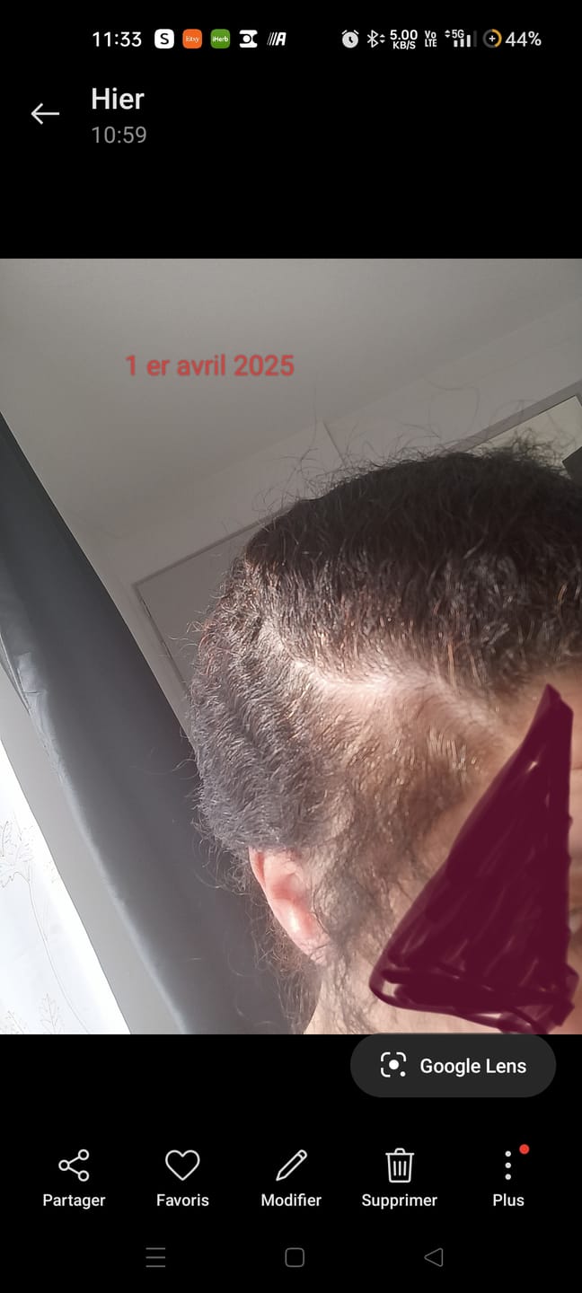 Customer photo review of Le duo booster de croissance