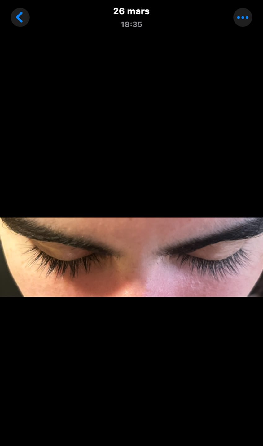 Customer photo review of SÉRUM AURA LASH