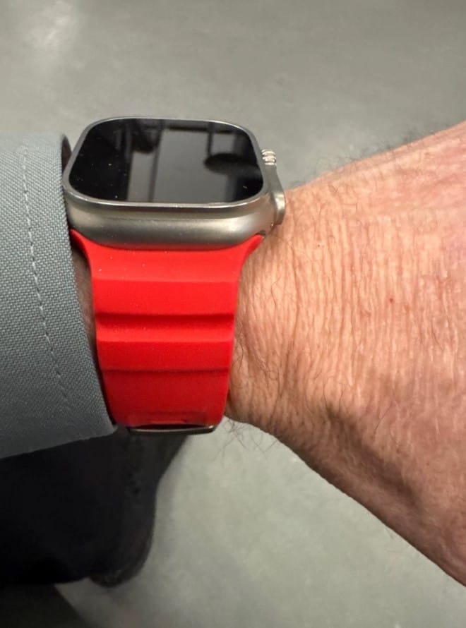 Customer photo review of Sport Soft Silicone and Titanium Buckle Strap for Apple Watch