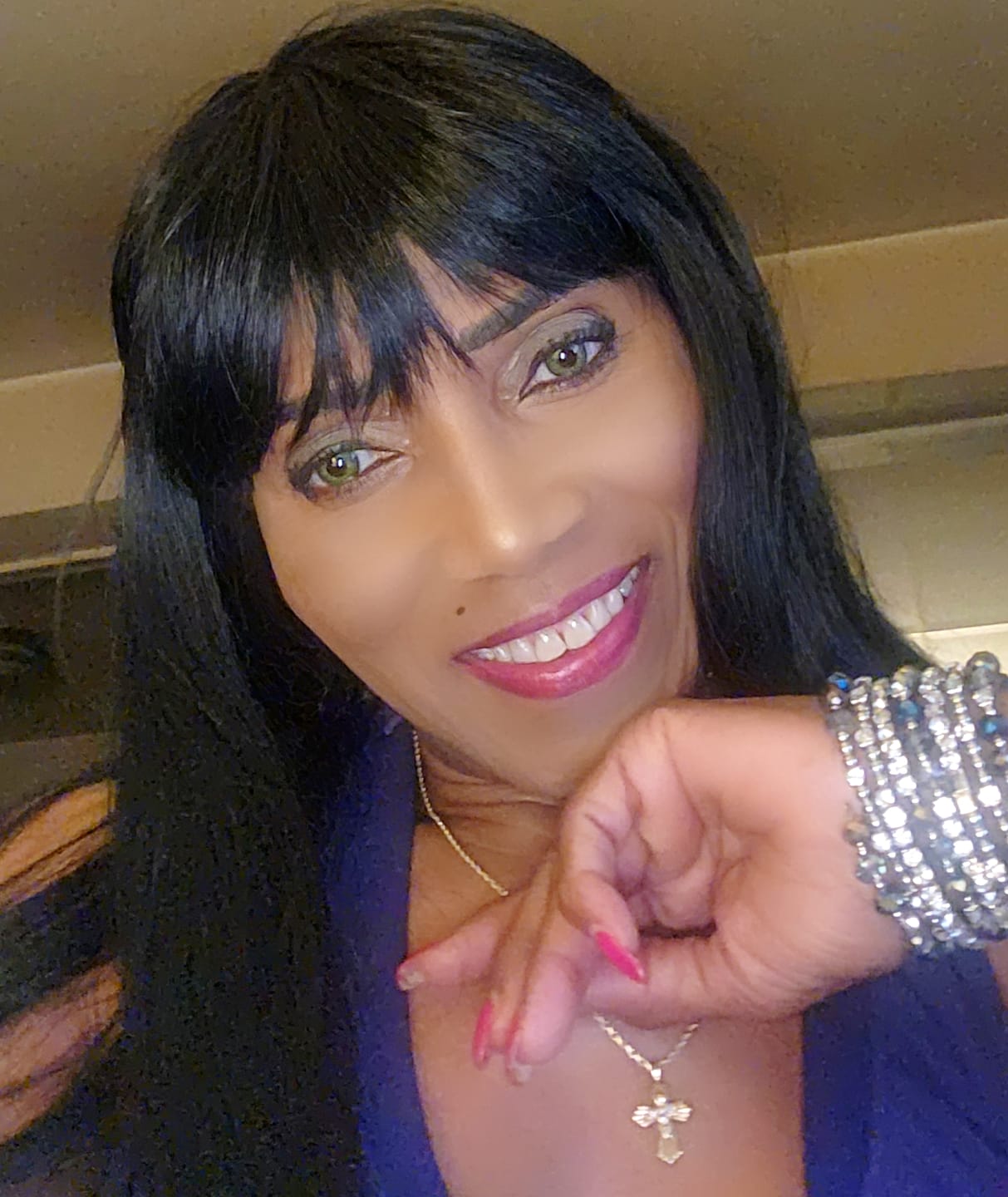 Customer photo review of New 3-Tone Green Prescription Colored Contact Lenses