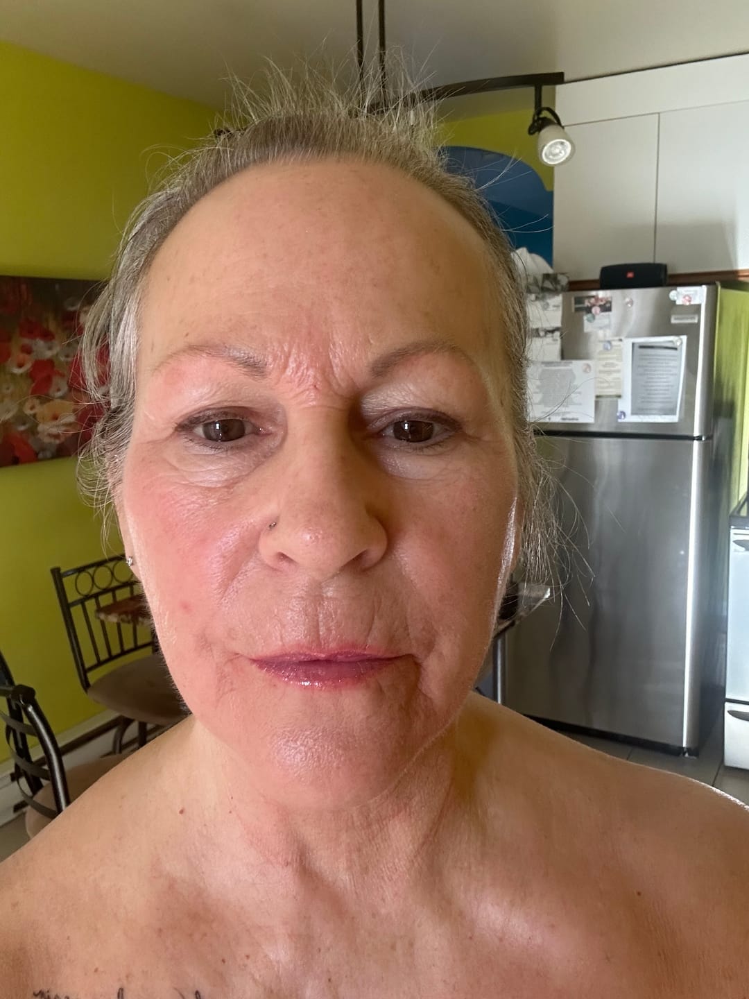 Customer photo review of Système de micro perfusion Glov Beauté