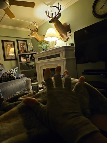 Customer photo review of Premium Onecompress™ Gloves