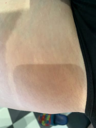 Customer photo review of Superfood Intimate Care Kit