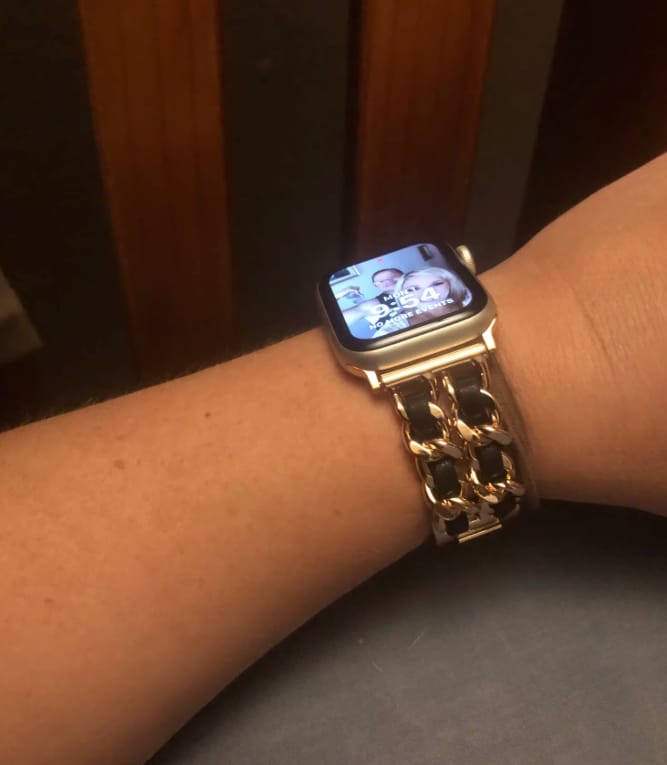 Customer photo review of Venice Bracelet for Apple Watch