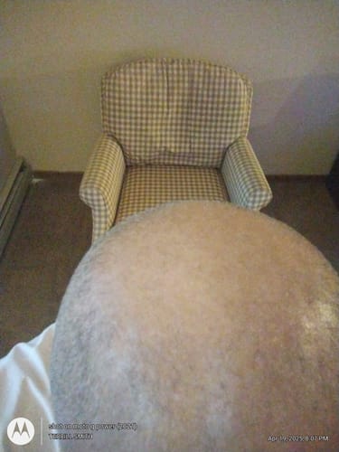 Customer photo review of Mini Herbal Hair Growth Oil