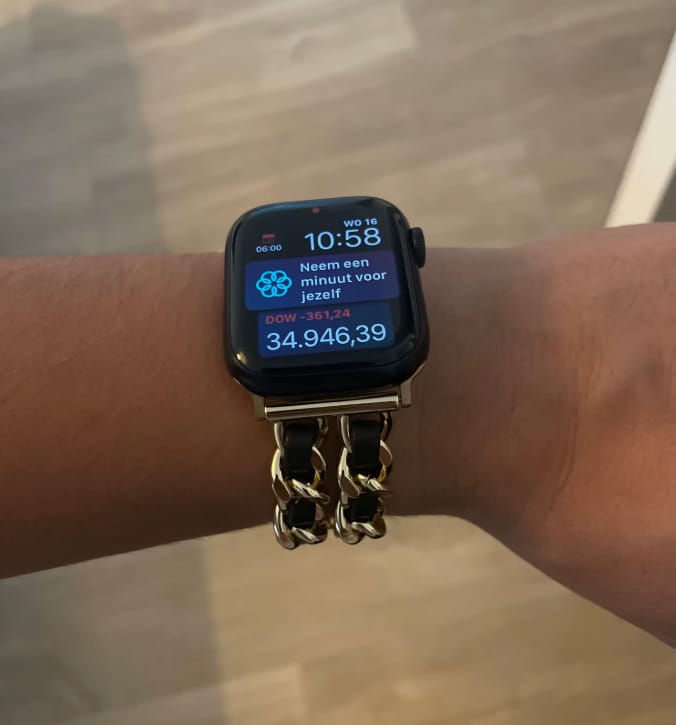 Customer photo review of Venice Bracelet for Apple Watch