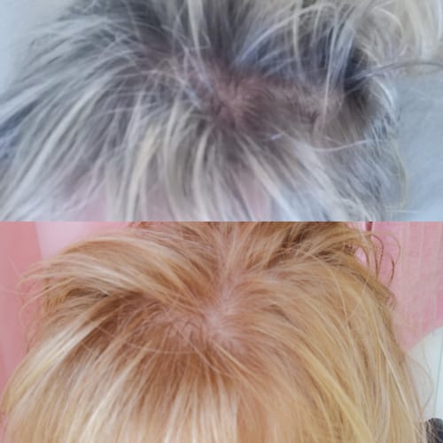 Customer photo review of Sunkissed Starter Kit