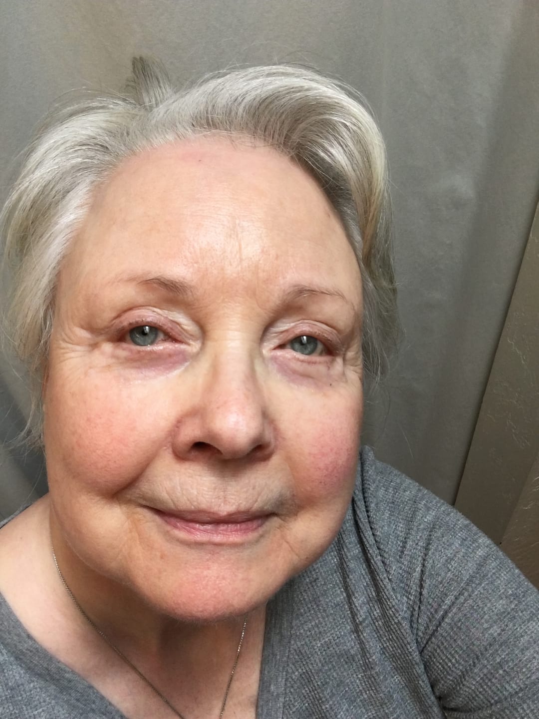 Customer photo review of 5 Star Age Defying Serum with Chebula + Hyaluronic Acid