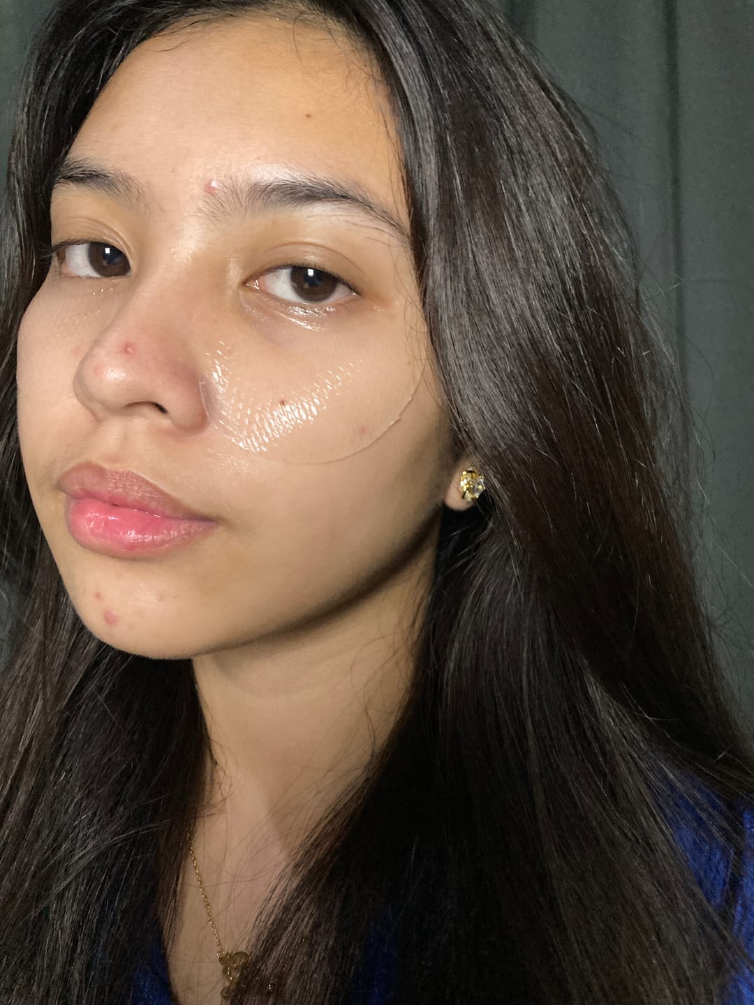 Customer photo review of Collagen eye patch Jericho rose jelly