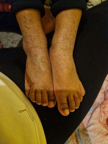 Customer photo review of Calm Balm