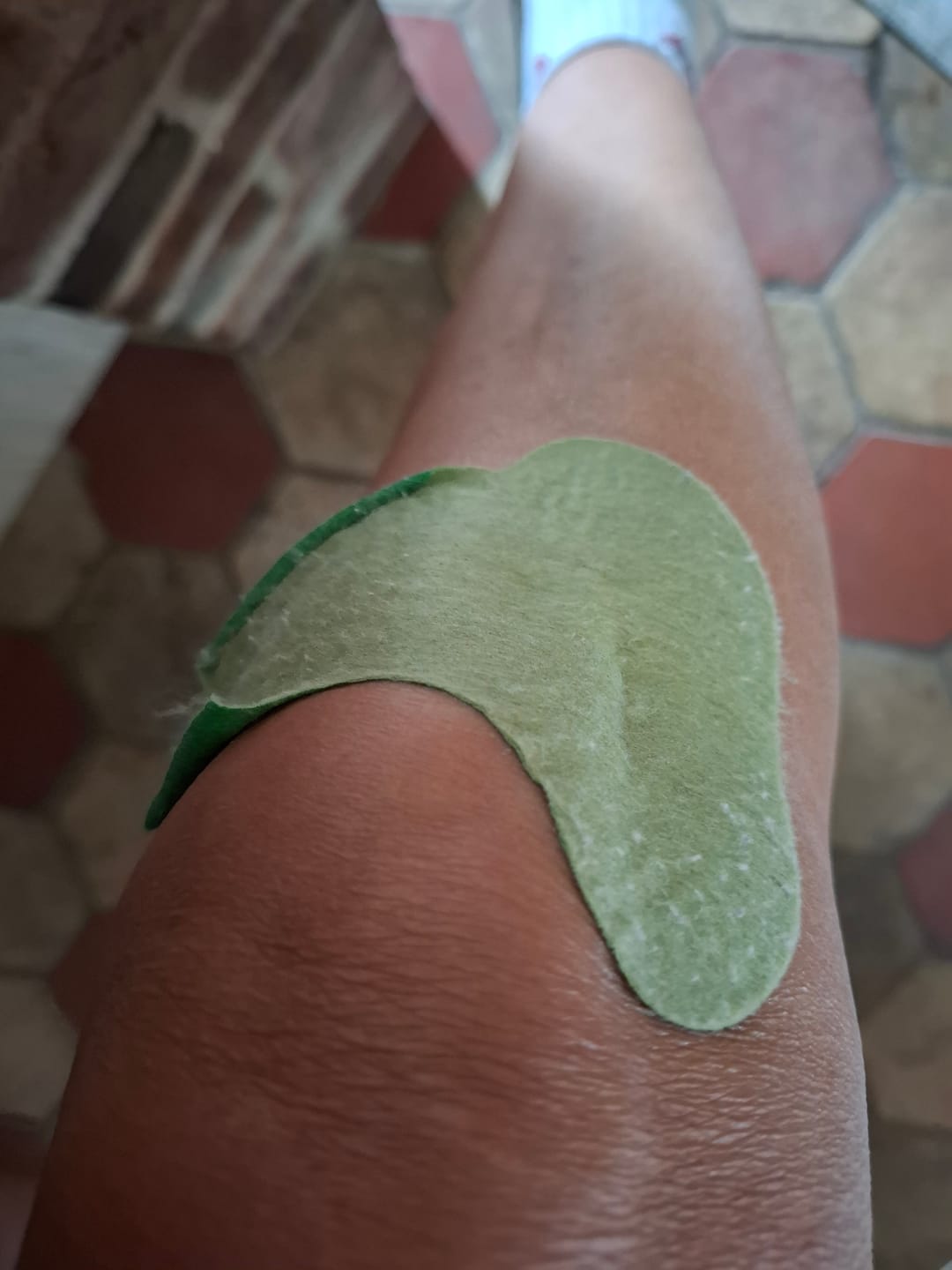 Customer photo review of Patchs anti-douleur