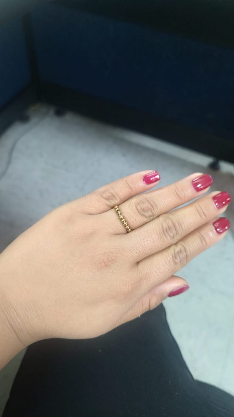 Customer photo review of Anillo Anti-Ansiedad