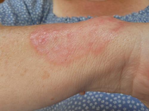 Customer photo review of Sea Cucumber Collagen Calming Cream