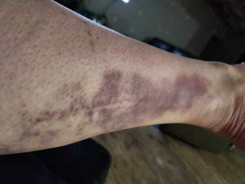 Customer photo review of Magnesium