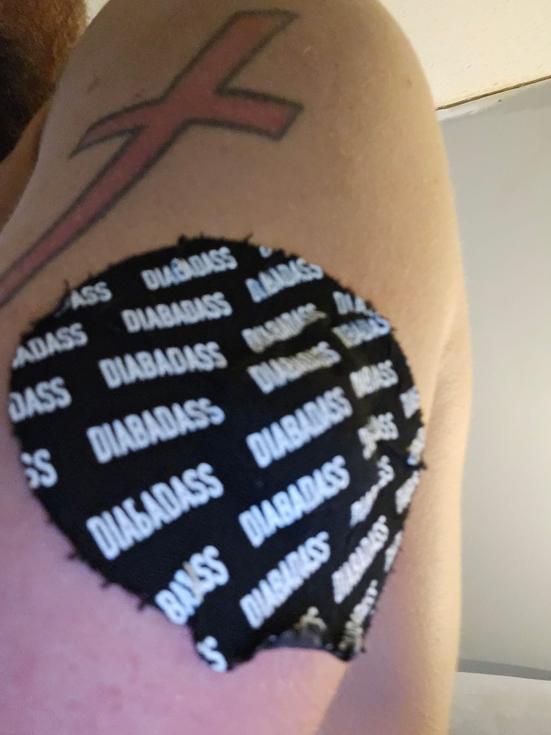 Customer photo review of Skin Grip Original - Medtronic Guardian/Enlite Adhesive Patches