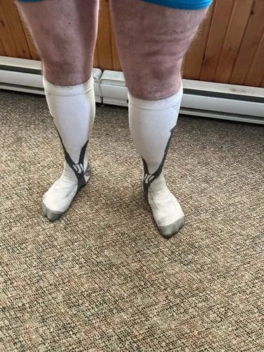 Customer photo review of ReliveX™ Compressiesokken