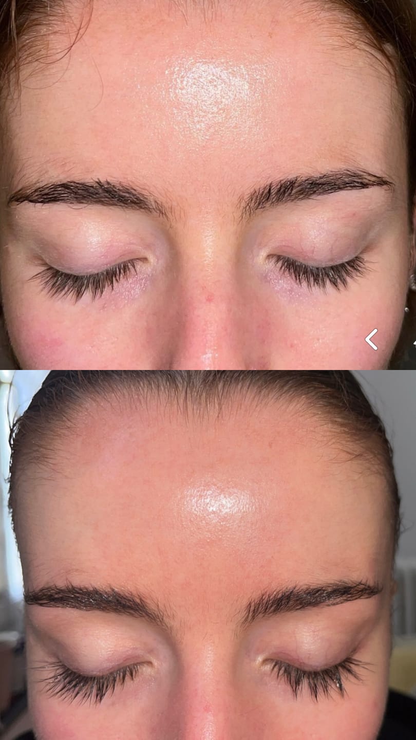 Customer photo review of SÉRUM DE CROISSANCE POUR CILS