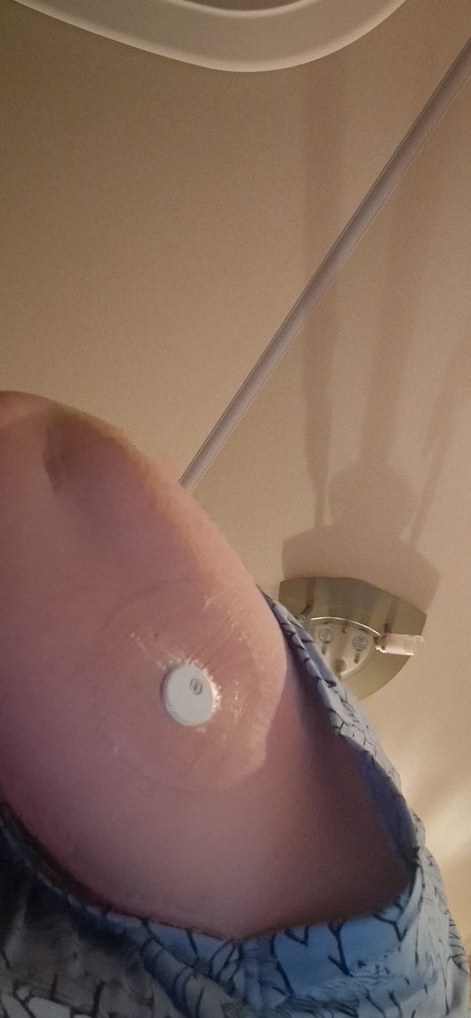 Customer photo review of Transparent CGM Patch för Freestyle Libre 1, 2 & 3