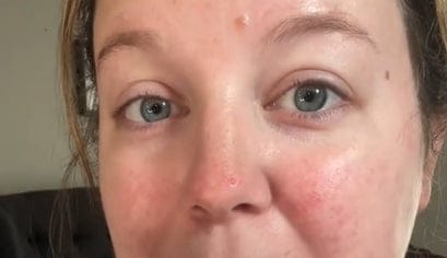 Customer photo review of Lash Remover