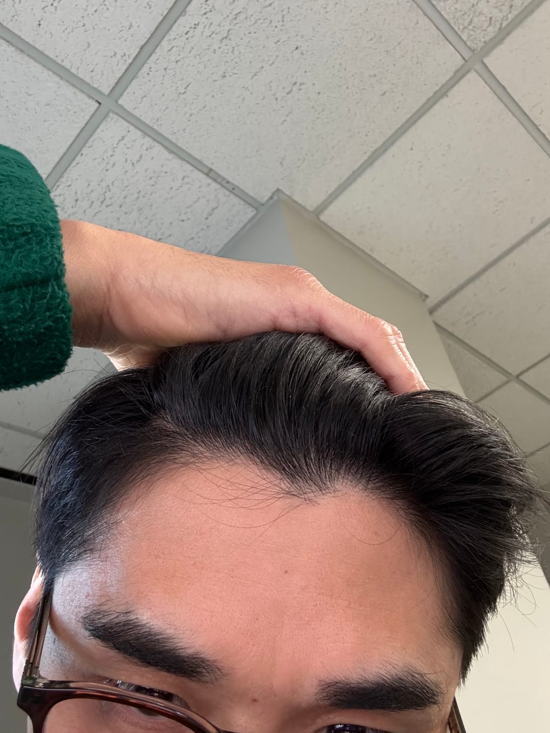 Customer photo review of HairRx