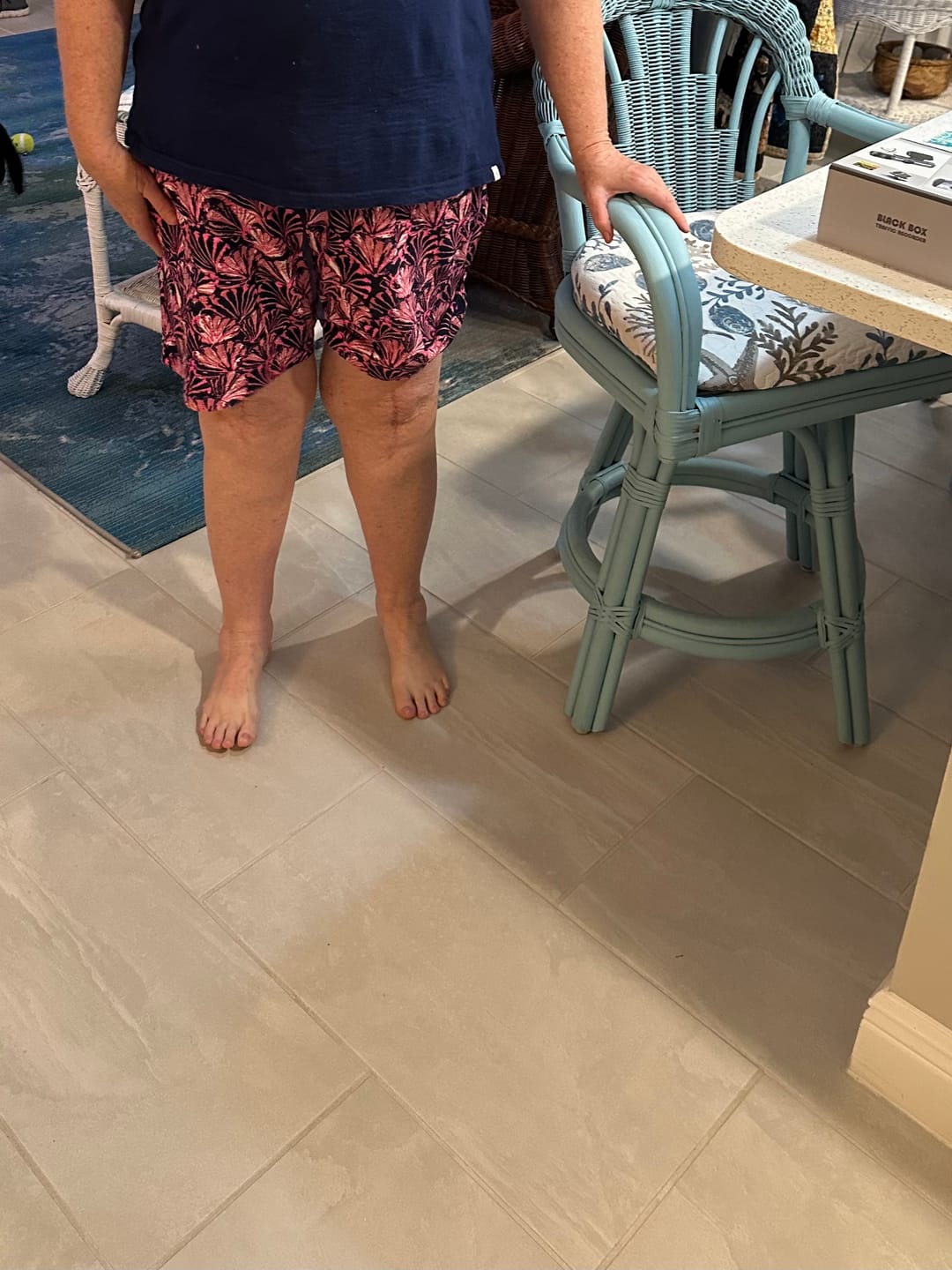 Customer photo review of Shell Cotton Shorts