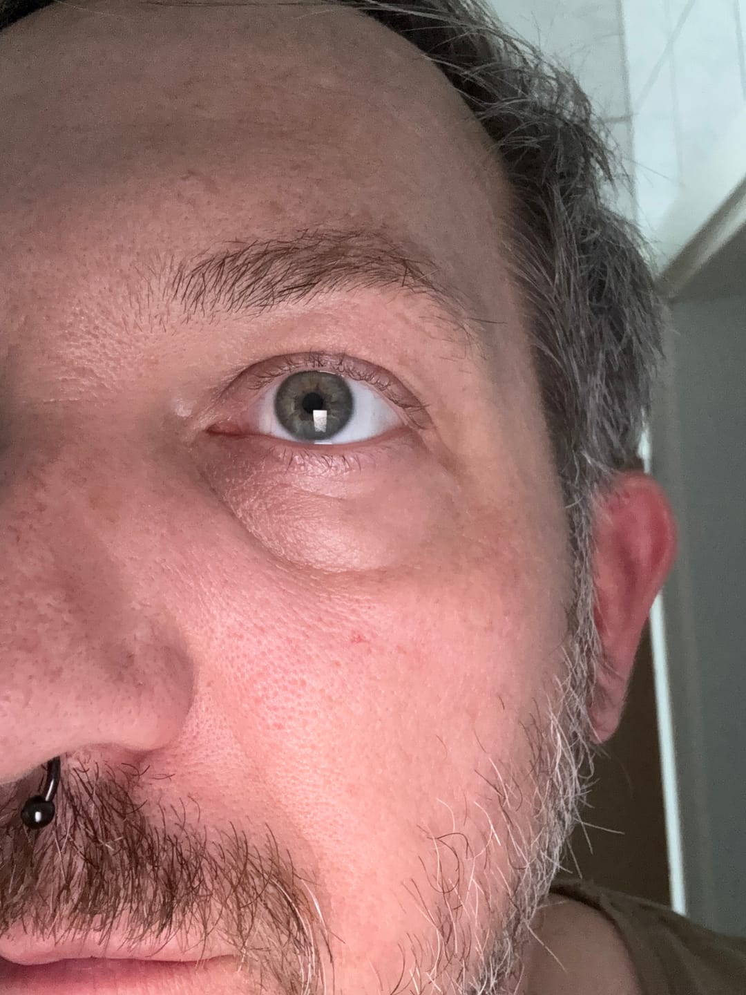 Customer photo review of EYEBAGHACK -  Express Eyelift Effect
