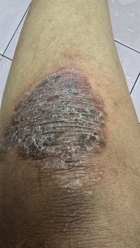 Customer photo review of Jolicare Cream