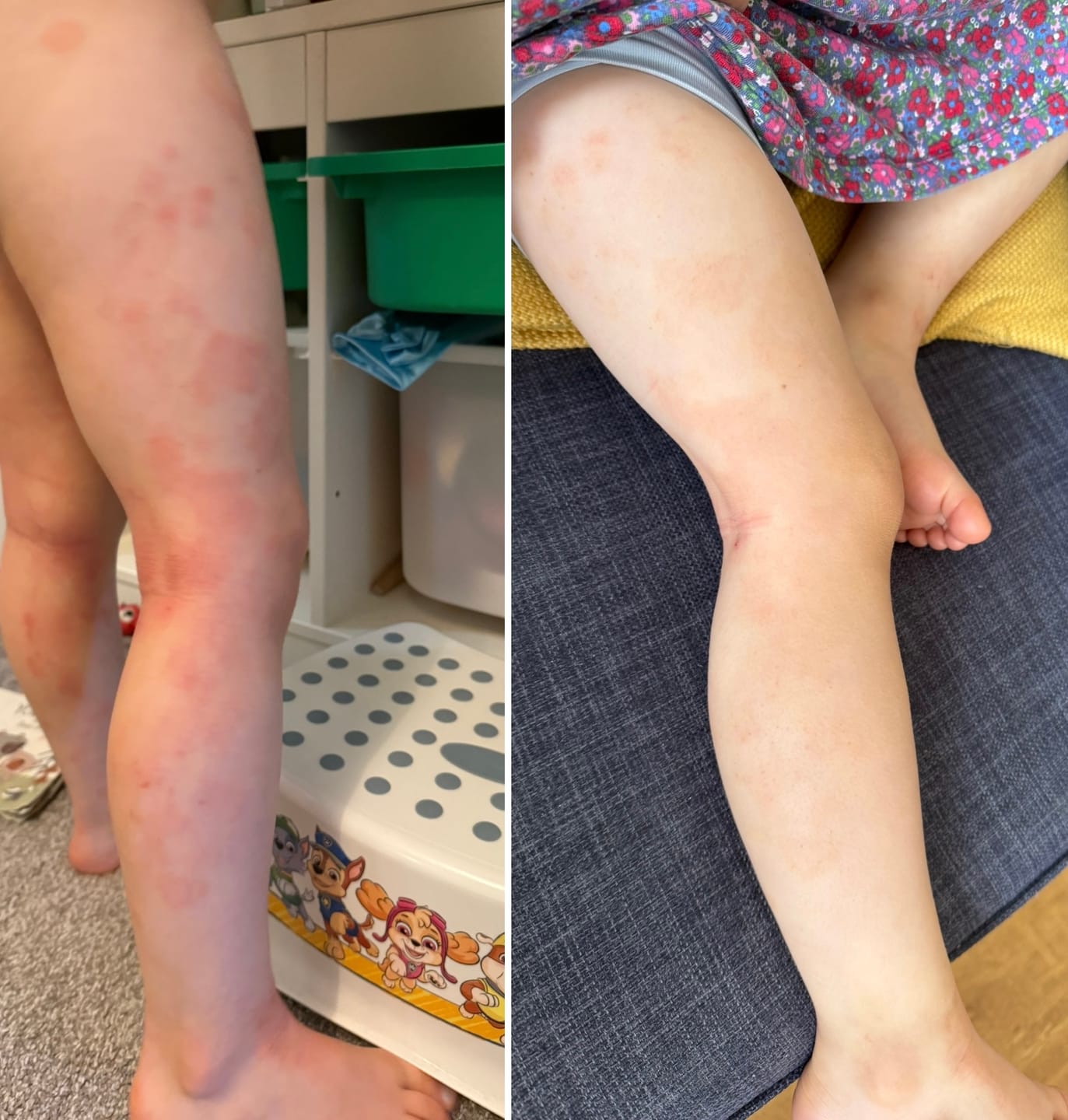 Customer photo review of Bioskin Junior Duo Pack