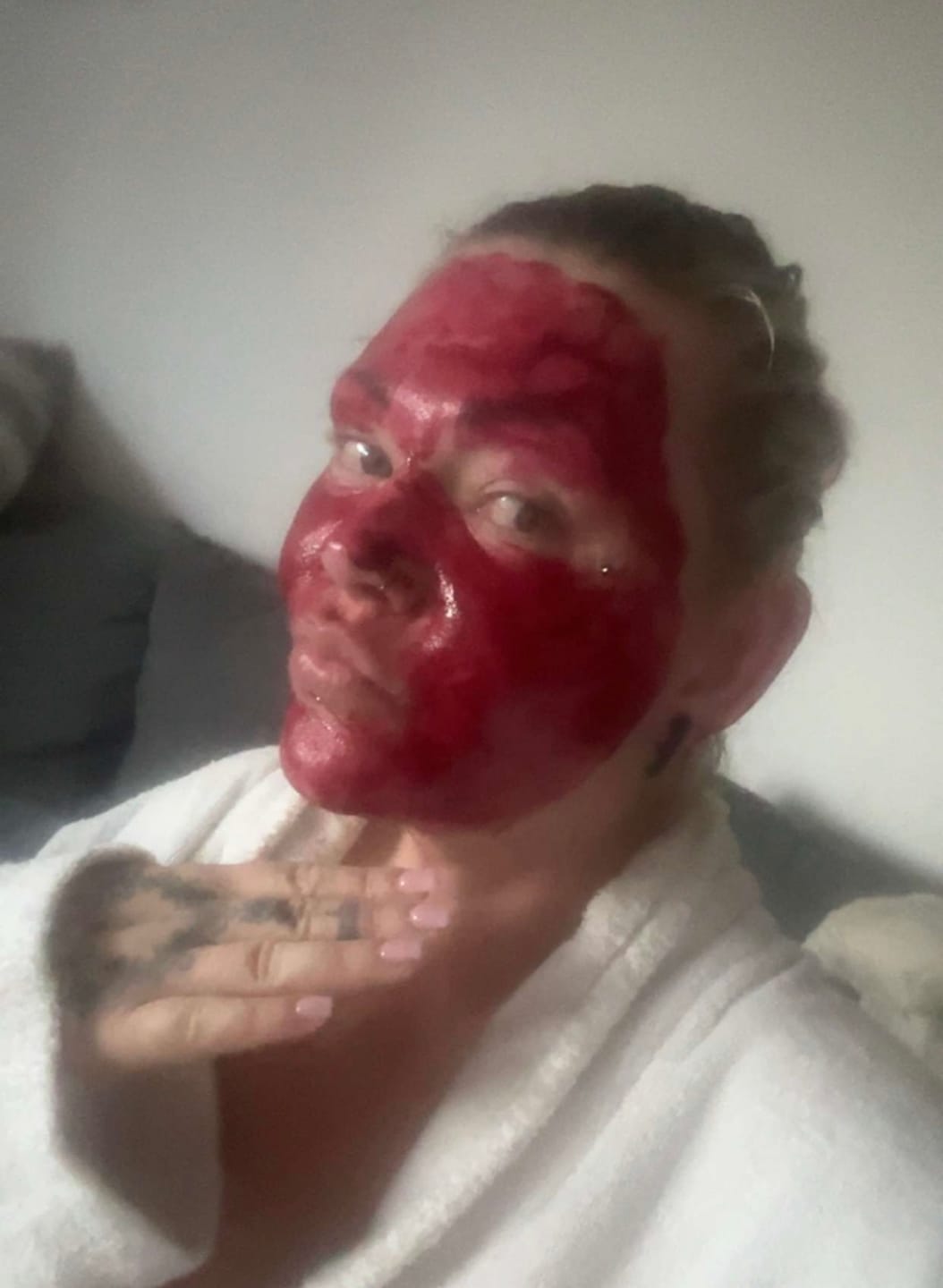Customer photo review of VAMPIRE PEEL - Fruchtsäurepeeling + PHYVE - Hyaluron Serum