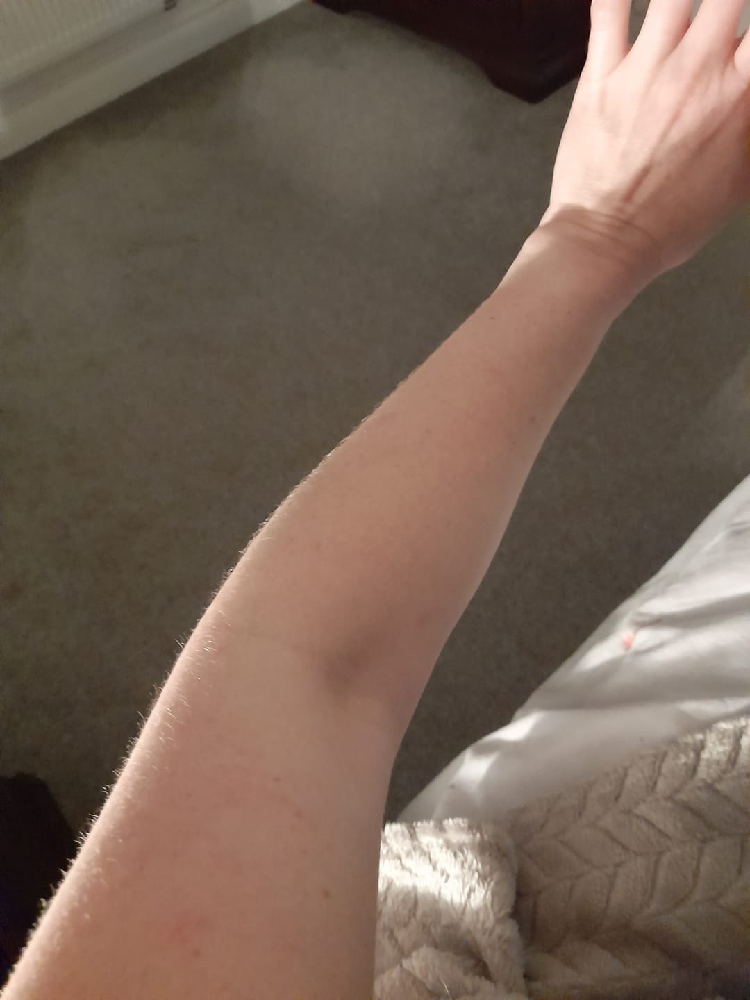 Customer photo review of Soothing Spray