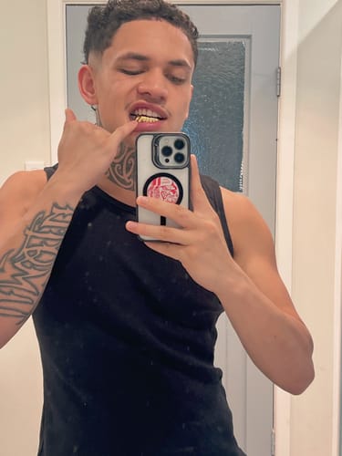 Customer photo review of NEXIUM (GOLD PLATED GRILLZ)