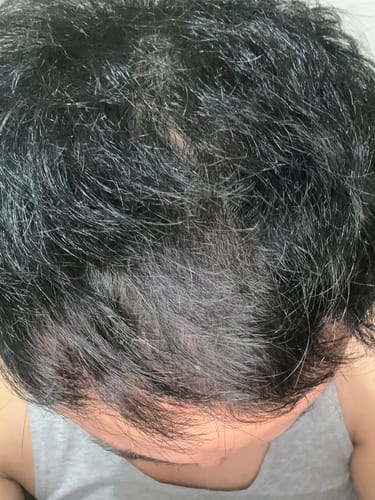 Customer photo review of Rosemary & Castor Oil for Hair Growth