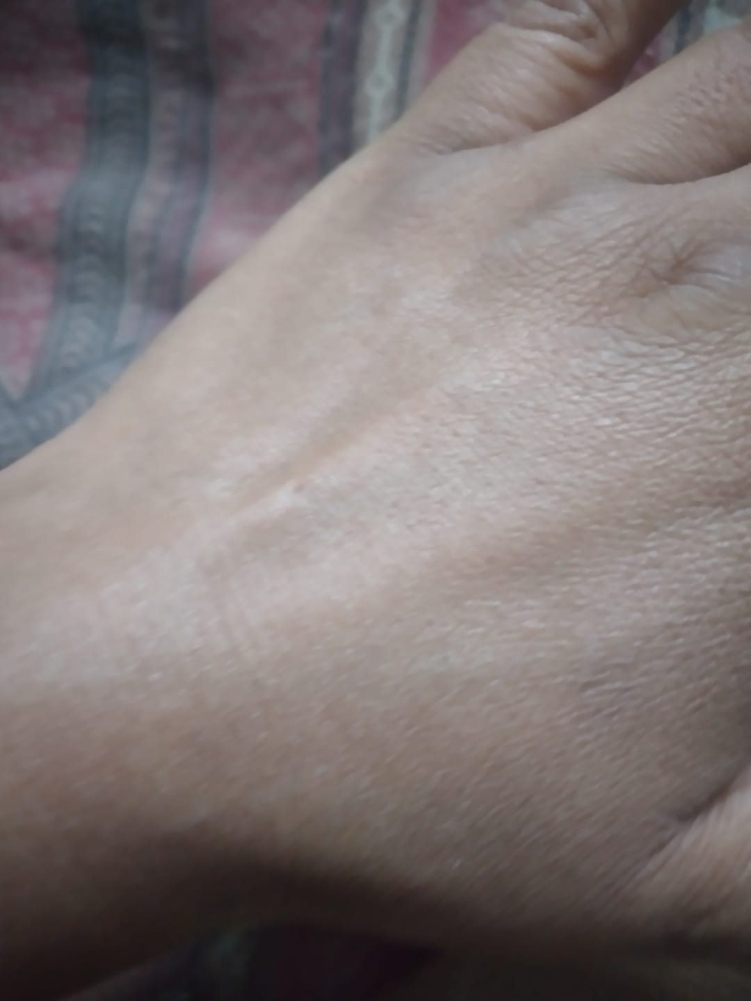 Customer photo review of GlycoBoost Radiant Skin Serum Crème