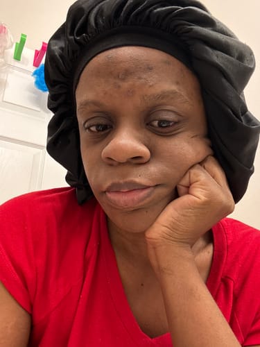 Customer photo review of Turmeric Block Cleanser BAR