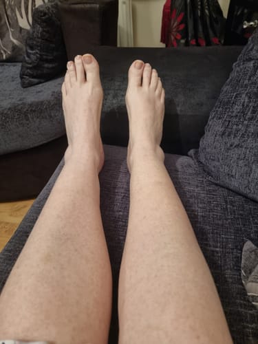 Customer photo review of Self Tanning 150 Capsules