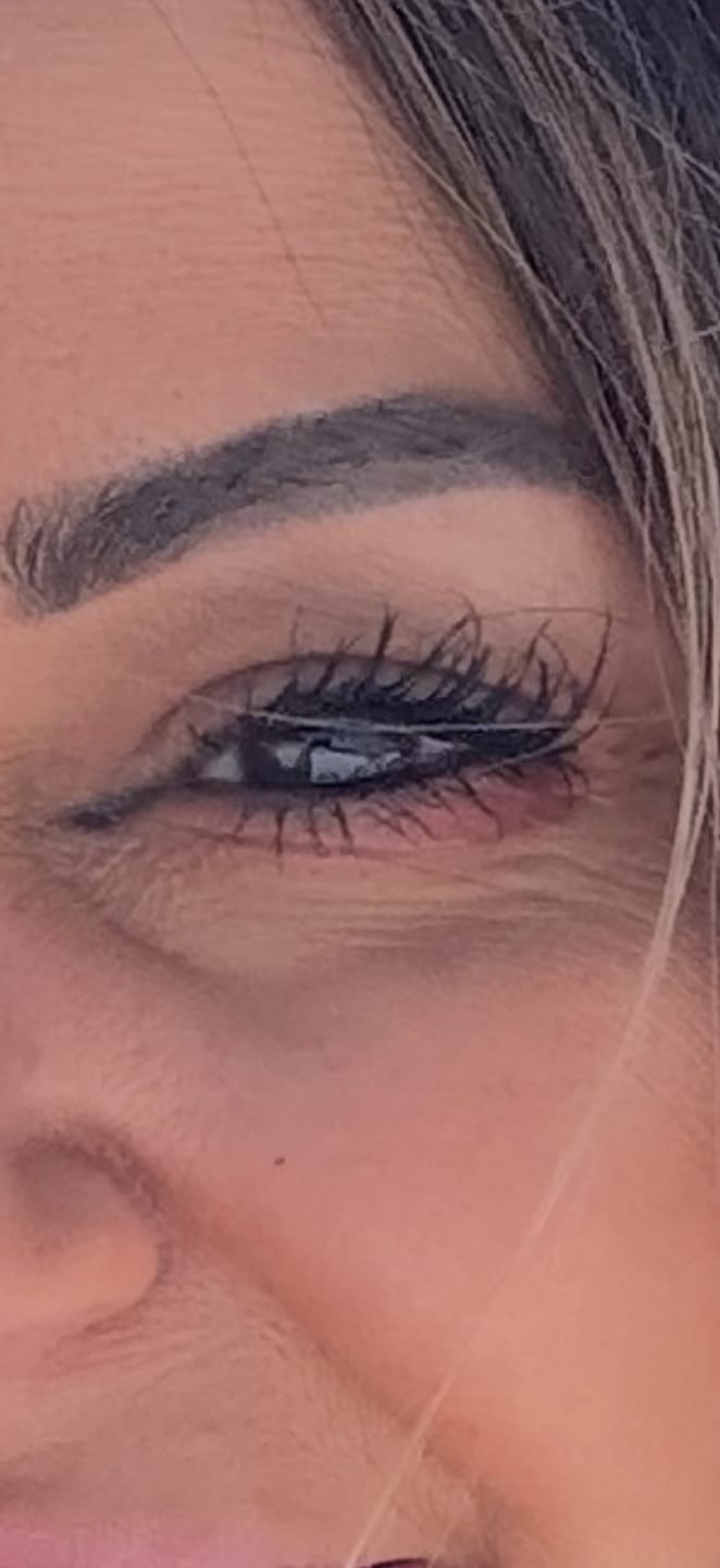 Customer photo review of fLASH EYELASH SERUM