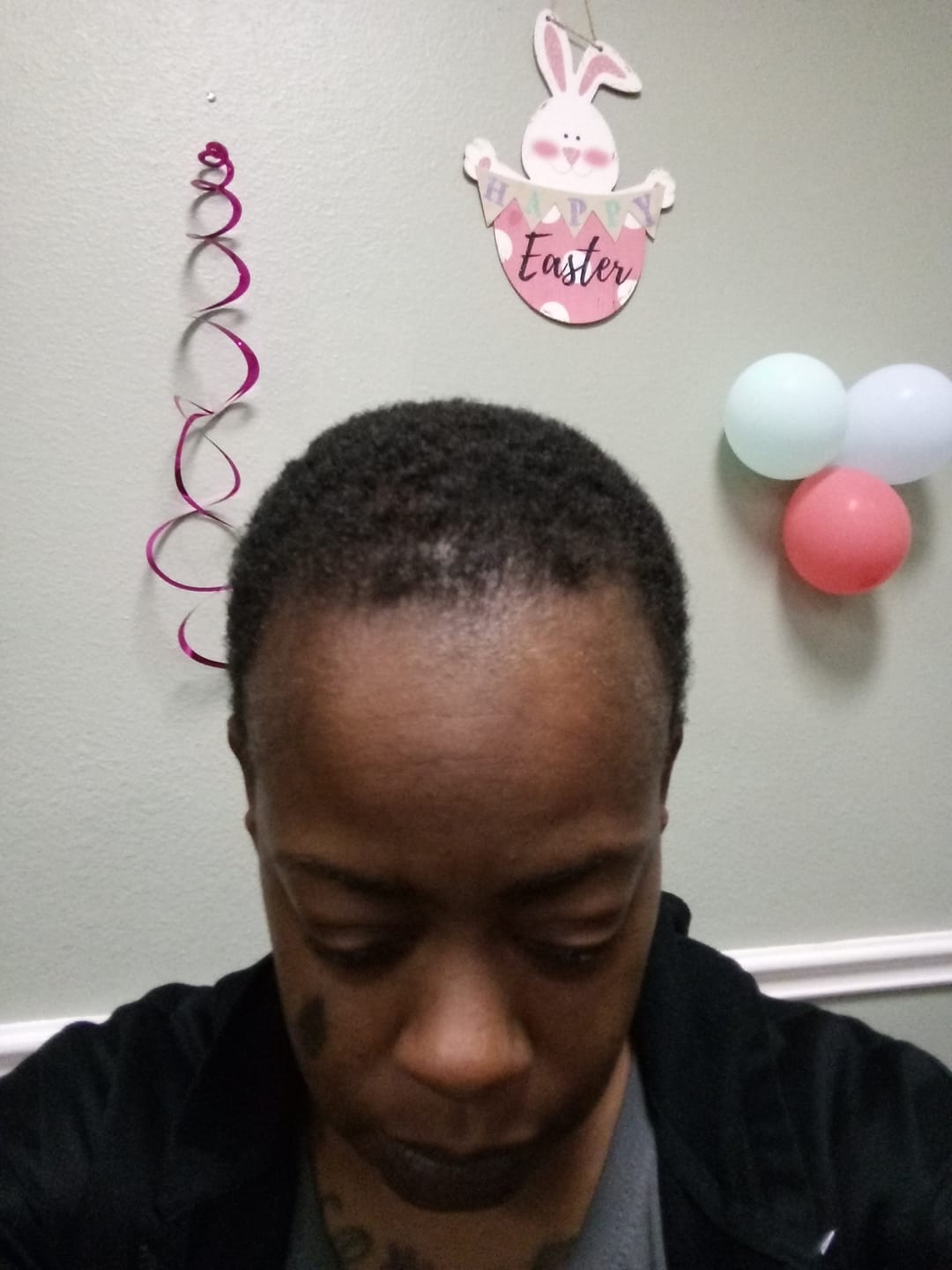 Customer photo review of Movatte 3-Phase Growth System™