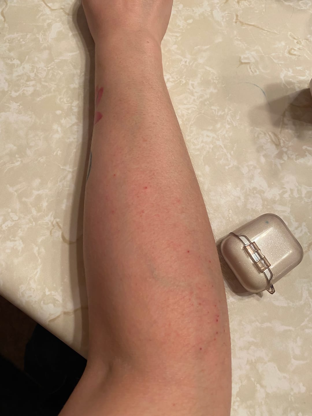 Customer photo review of Sea Soothe Dry Skin Relief Lotion