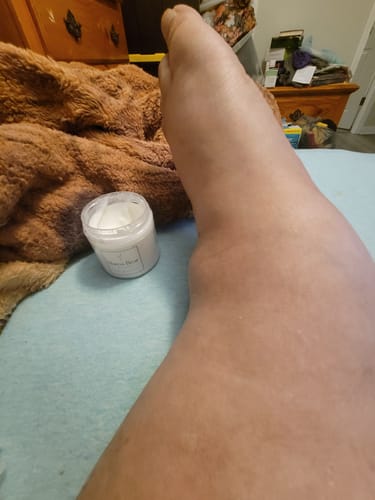 Customer photo review of Mama Bear Pregnancy Lotion