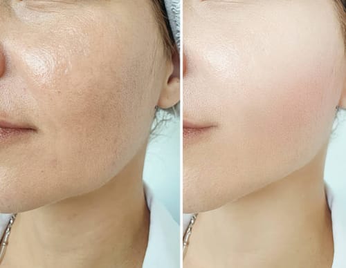 Customer photo review of Turmeric Collagen Facial Mask