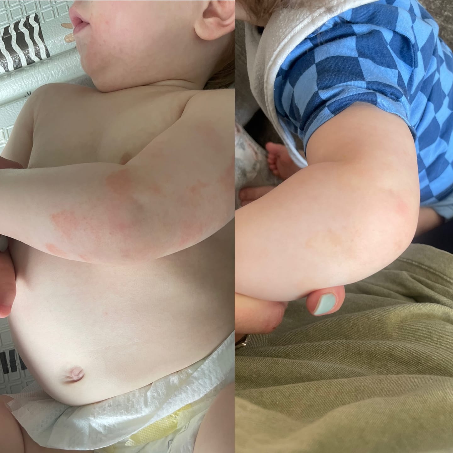 Customer photo review of Bioskin Junior Duo Pack