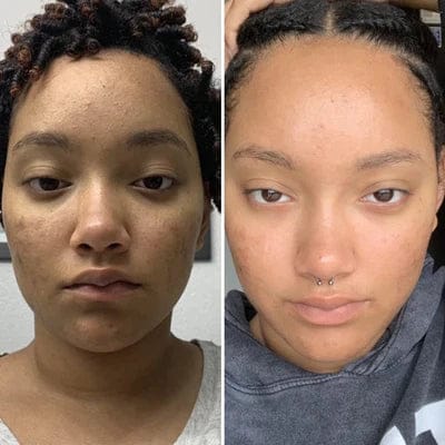 Customer photo review of Turmeric Collagen Facial Mask