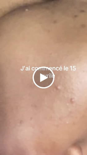 Customer video review of KIT ViSAGE BISCUIT