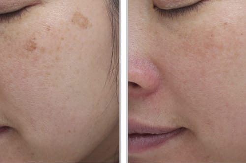 Customer photo review of Turmeric Collagen Facial Mask
